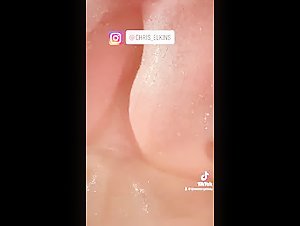 Thumb 7